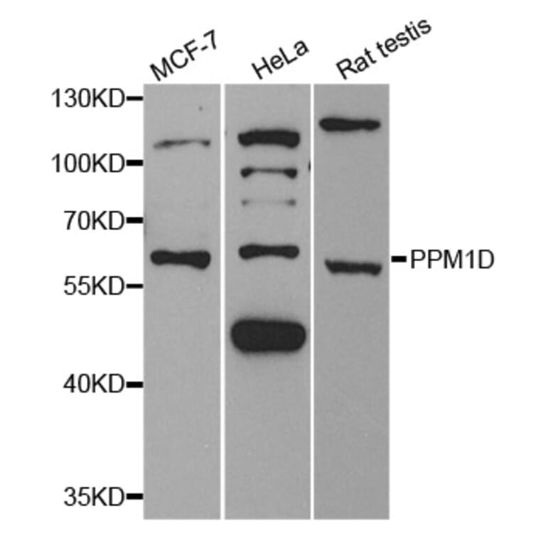 Western blot - PPM1D Antibody from Signalway Antibody (33112) - Antibodies.com