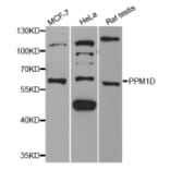 Western blot - PPM1D Antibody from Signalway Antibody (33112) - Antibodies.com