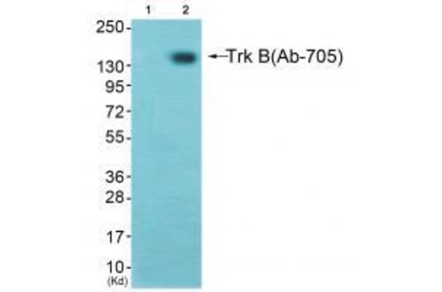 Western blot - Trk B Antibody from Signalway Antibody (33119) - Antibodies.com