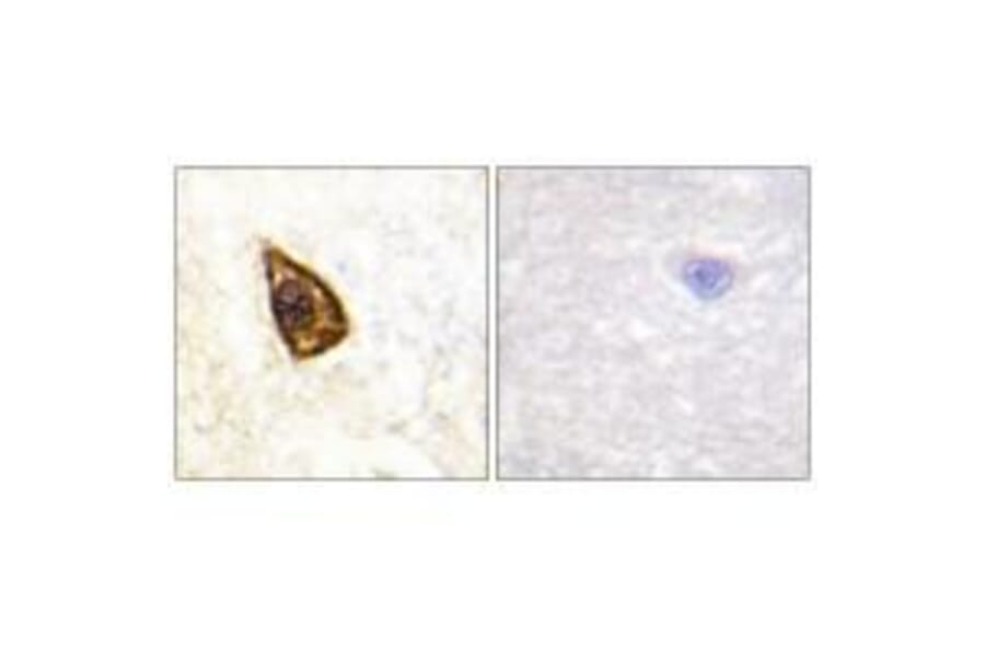 Immunohistochemistry - Trk B Antibody from Signalway Antibody (33119) - Antibodies.com