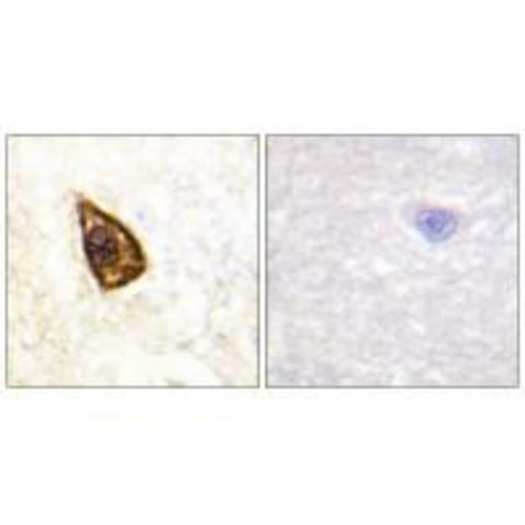 Immunohistochemistry - Trk B Antibody from Signalway Antibody (33119) - Antibodies.com
