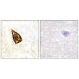 Immunohistochemistry - Trk B Antibody from Signalway Antibody (33119) - Antibodies.com