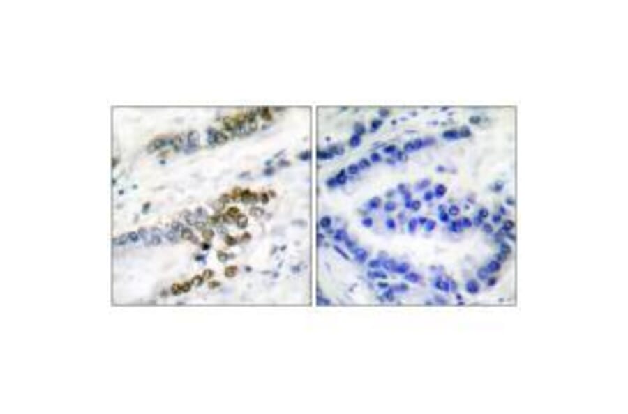 Immunohistochemistry - ERCC1 Antibody from Signalway Antibody (33366) - Antibodies.com
