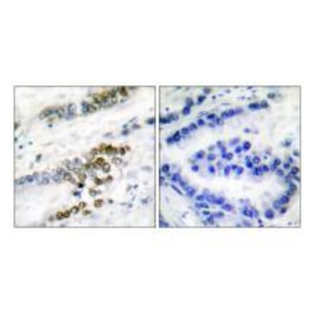 Immunohistochemistry - ERCC1 Antibody from Signalway Antibody (33366) - Antibodies.com