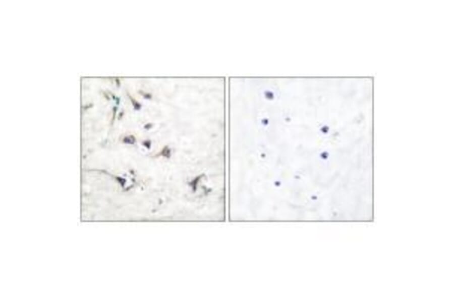 Immunohistochemistry - Ezrin Antibody from Signalway Antibody (33368) - Antibodies.com