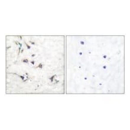 Immunohistochemistry - Ezrin Antibody from Signalway Antibody (33368) - Antibodies.com