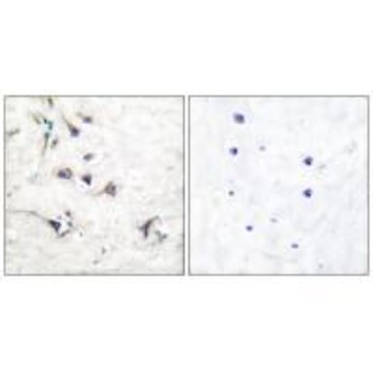 Immunohistochemistry - Ezrin Antibody from Signalway Antibody (33368) - Antibodies.com