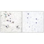 Immunohistochemistry - Ezrin Antibody from Signalway Antibody (33368) - Antibodies.com