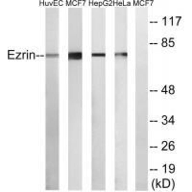 Western blot - Ezrin Antibody from Signalway Antibody (33368) - Antibodies.com