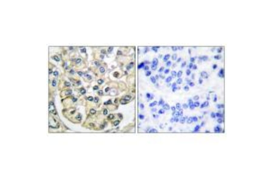 Immunohistochemistry - FGFR2 Antibody from Signalway Antibody (33372) - Antibodies.com