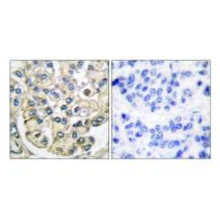 Immunohistochemistry - FGFR2 Antibody from Signalway Antibody (33372) - Antibodies.com