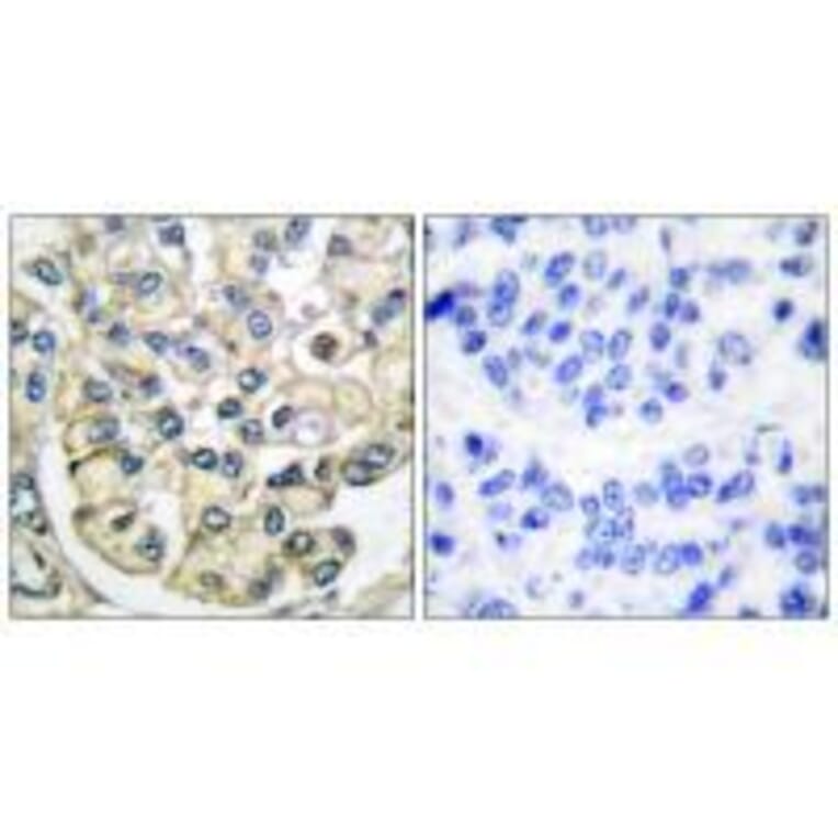 Immunohistochemistry - FGFR2 Antibody from Signalway Antibody (33372) - Antibodies.com
