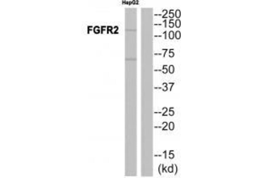 Western blot - FGFR2 Antibody from Signalway Antibody (33372) - Antibodies.com