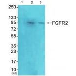 Western blot - FGFR2 Antibody from Signalway Antibody (33372) - Antibodies.com