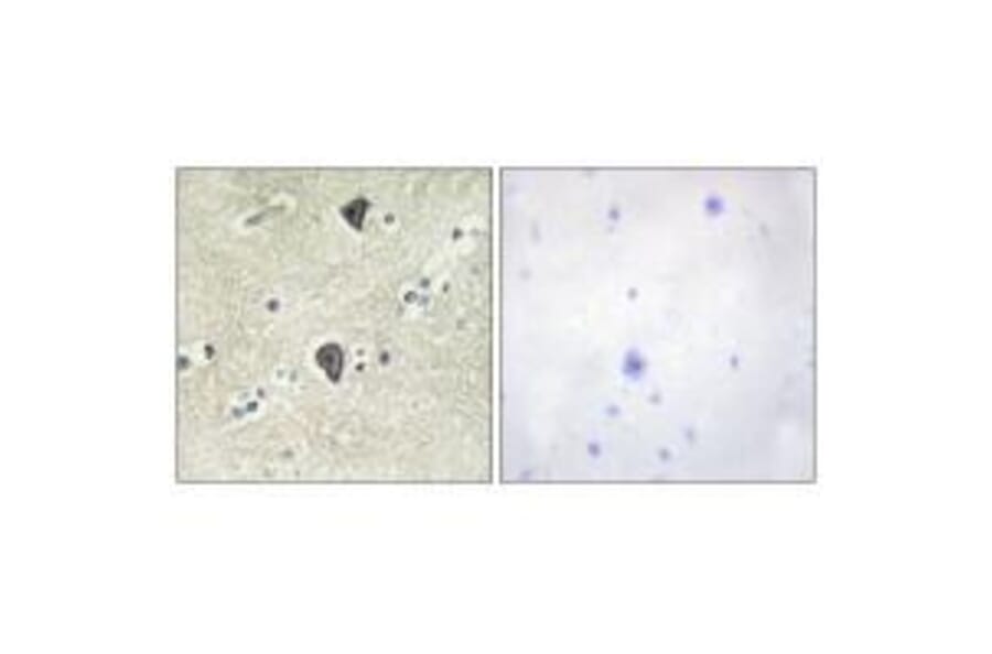 Immunohistochemistry - FGFR3 Antibody from Signalway Antibody (33373) - Antibodies.com