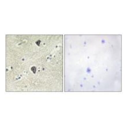 Immunohistochemistry - FGFR3 Antibody from Signalway Antibody (33373) - Antibodies.com
