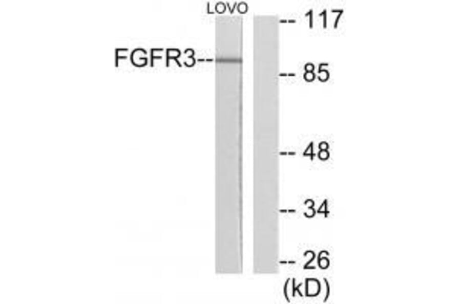 Western blot - FGFR3 Antibody from Signalway Antibody (33373) - Antibodies.com