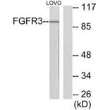 Western blot - FGFR3 Antibody from Signalway Antibody (33373) - Antibodies.com