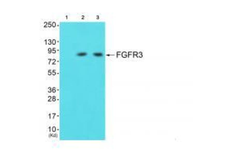 Western blot - FGFR3 Antibody from Signalway Antibody (33373) - Antibodies.com