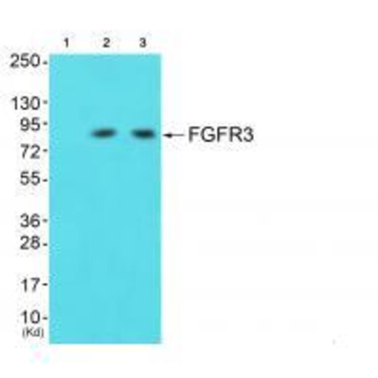 Western blot - FGFR3 Antibody from Signalway Antibody (33373) - Antibodies.com