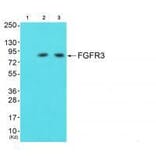 Western blot - FGFR3 Antibody from Signalway Antibody (33373) - Antibodies.com
