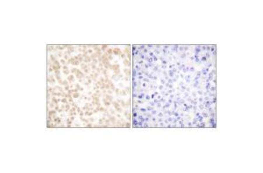 Immunohistochemistry - Fra-2 Antibody from Signalway Antibody (33377) - Antibodies.com
