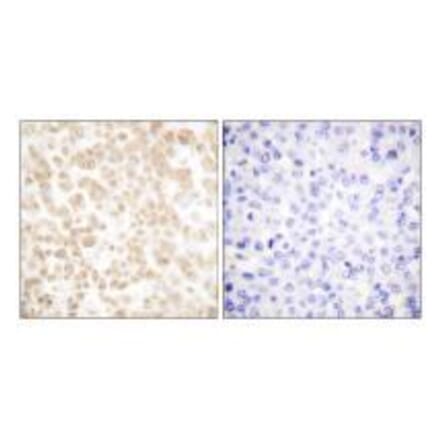 Immunohistochemistry - Fra-2 Antibody from Signalway Antibody (33377) - Antibodies.com