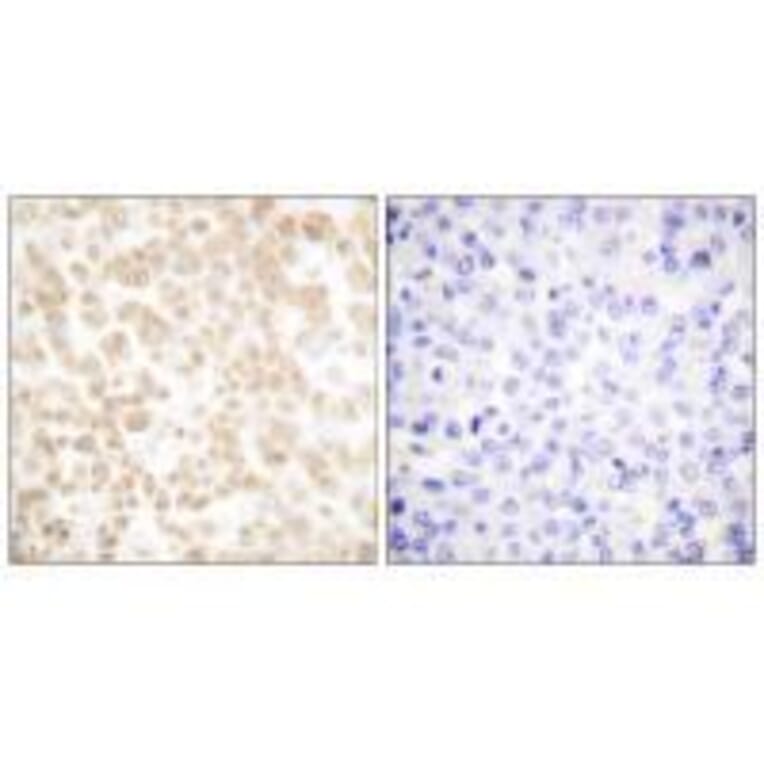 Immunohistochemistry - Fra-2 Antibody from Signalway Antibody (33377) - Antibodies.com