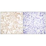 Immunohistochemistry - Fra-2 Antibody from Signalway Antibody (33377) - Antibodies.com