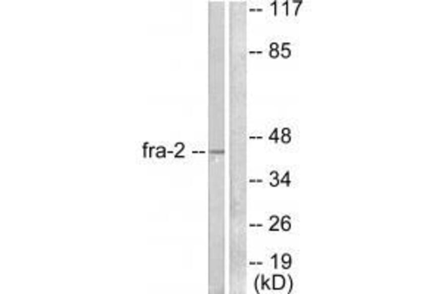 Western blot - Fra-2 Antibody from Signalway Antibody (33377) - Antibodies.com
