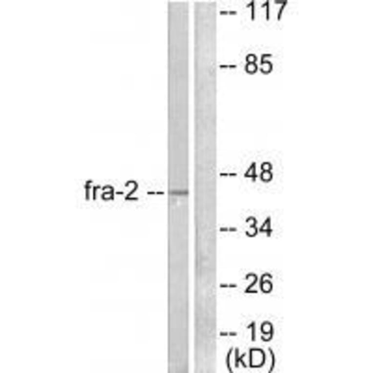 Western blot - Fra-2 Antibody from Signalway Antibody (33377) - Antibodies.com