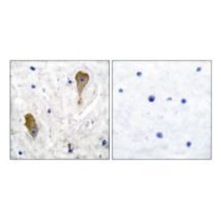 Immunohistochemistry - GAD67 Antibody from Signalway Antibody (33379) - Antibodies.com