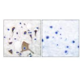 Immunohistochemistry - GluR5 Antibody from Signalway Antibody (33388) - Antibodies.com