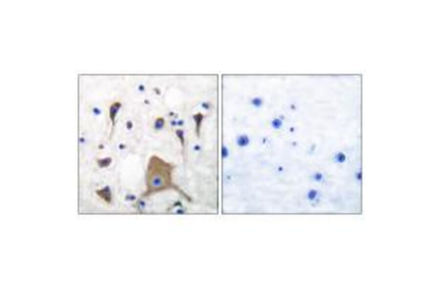 Immunohistochemistry - GluR5 Antibody from Signalway Antibody (33388) - Antibodies.com