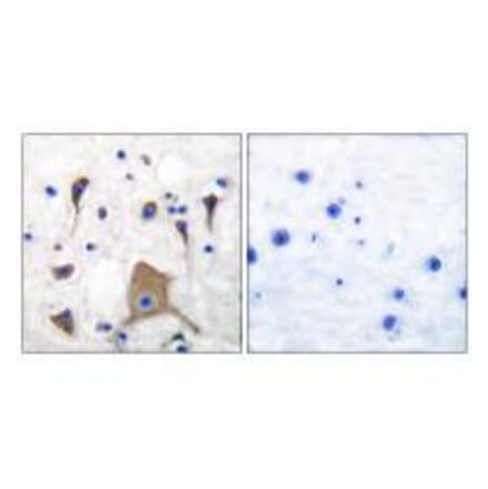 Immunohistochemistry - GluR5 Antibody from Signalway Antibody (33388) - Antibodies.com