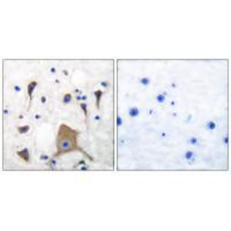 Immunohistochemistry - GluR5 Antibody from Signalway Antibody (33388) - Antibodies.com