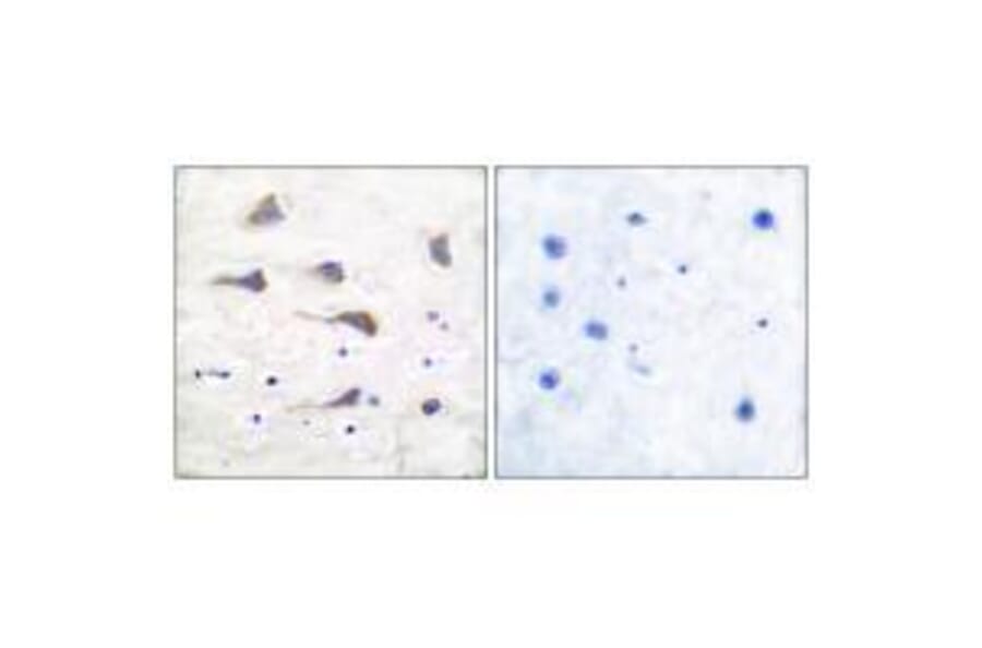 Immunohistochemistry - GluR6 Antibody from Signalway Antibody (33389) - Antibodies.com