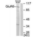 Western blot - GluR6 Antibody from Signalway Antibody (33389) - Antibodies.com