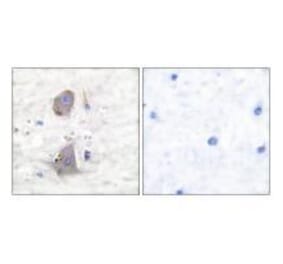Immunohistochemistry - GLUT1 Antibody from Signalway Antibody (33392) - Antibodies.com