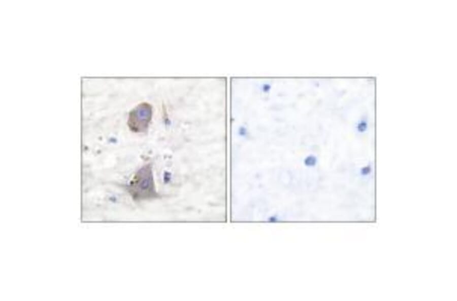 Immunohistochemistry - GLUT1 Antibody from Signalway Antibody (33392) - Antibodies.com