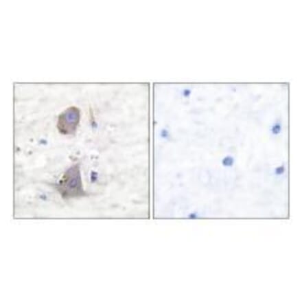 Immunohistochemistry - GLUT1 Antibody from Signalway Antibody (33392) - Antibodies.com