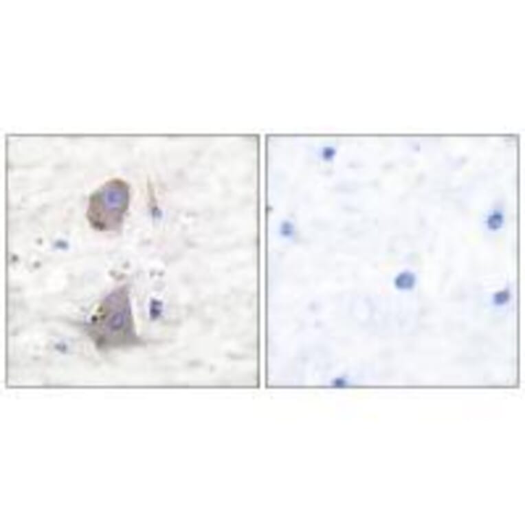 Immunohistochemistry - GLUT1 Antibody from Signalway Antibody (33392) - Antibodies.com