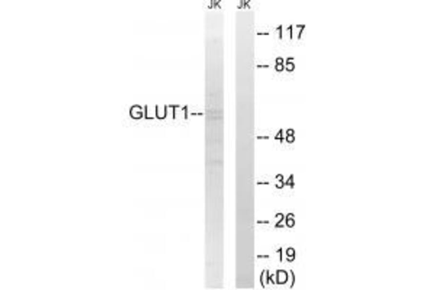 Western blot - GLUT1 Antibody from Signalway Antibody (33392) - Antibodies.com