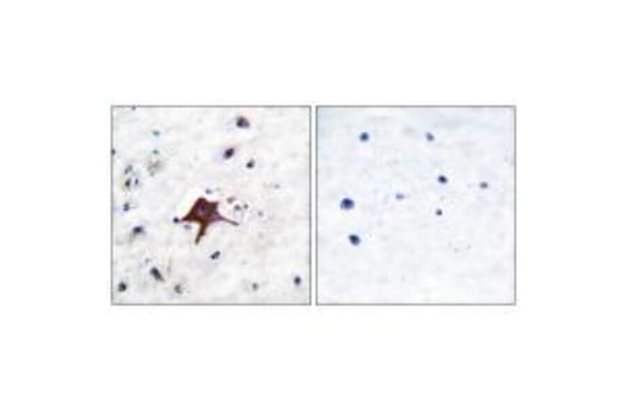 Immunohistochemistry - GLUT3 Antibody from Signalway Antibody (33393) - Antibodies.com