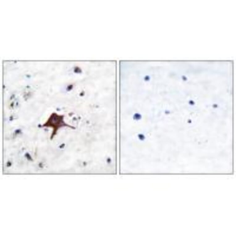 Immunohistochemistry - GLUT3 Antibody from Signalway Antibody (33393) - Antibodies.com