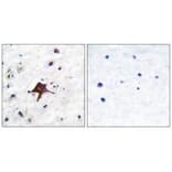 Immunohistochemistry - GLUT3 Antibody from Signalway Antibody (33393) - Antibodies.com