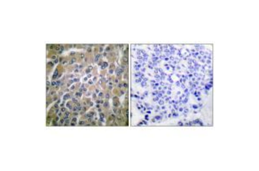Immunohistochemistry - hCG β Antibody from Signalway Antibody (33397) - Antibodies.com
