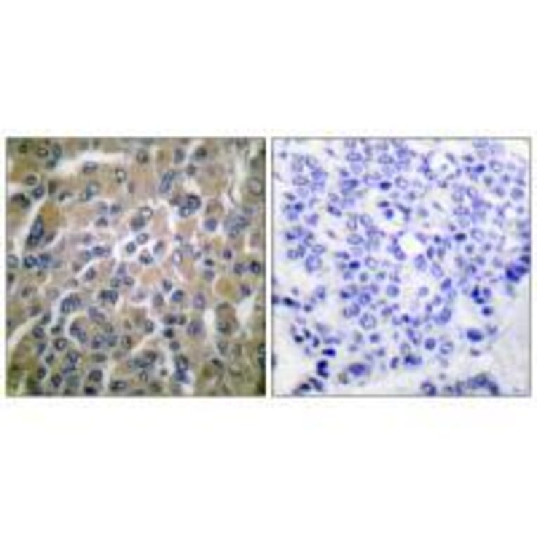 Immunohistochemistry - hCG β Antibody from Signalway Antibody (33397) - Antibodies.com
