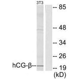 Western blot - hCG β Antibody from Signalway Antibody (33397) - Antibodies.com