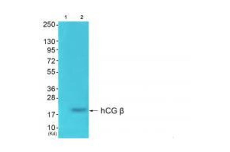 Western blot - hCG β Antibody from Signalway Antibody (33397) - Antibodies.com